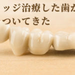 抜歯しない・削らない歯科治療なら香川県高松市の吉本歯科医院