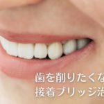 歯を削らないブリッジ治療なら香川県 高松市 吉本歯科医院｜接着ブリッジ治療