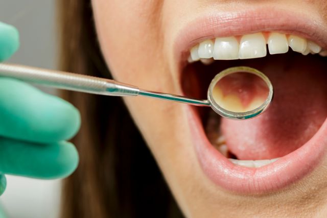歯をなるべく残す治療｜高松市の歯医者なら吉本歯科医院